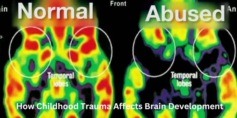 How childhood trauma affects brain development changes